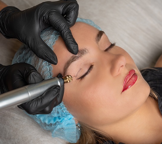 Plasma Fibroblast treatment
